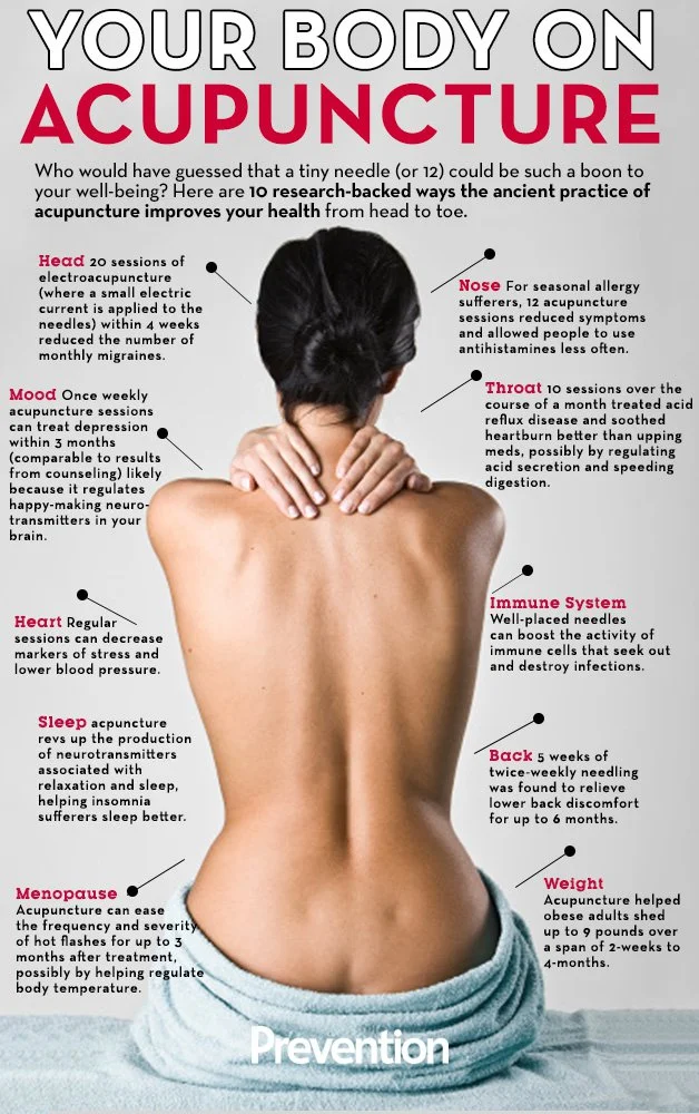 accupuncture-your-body-on
